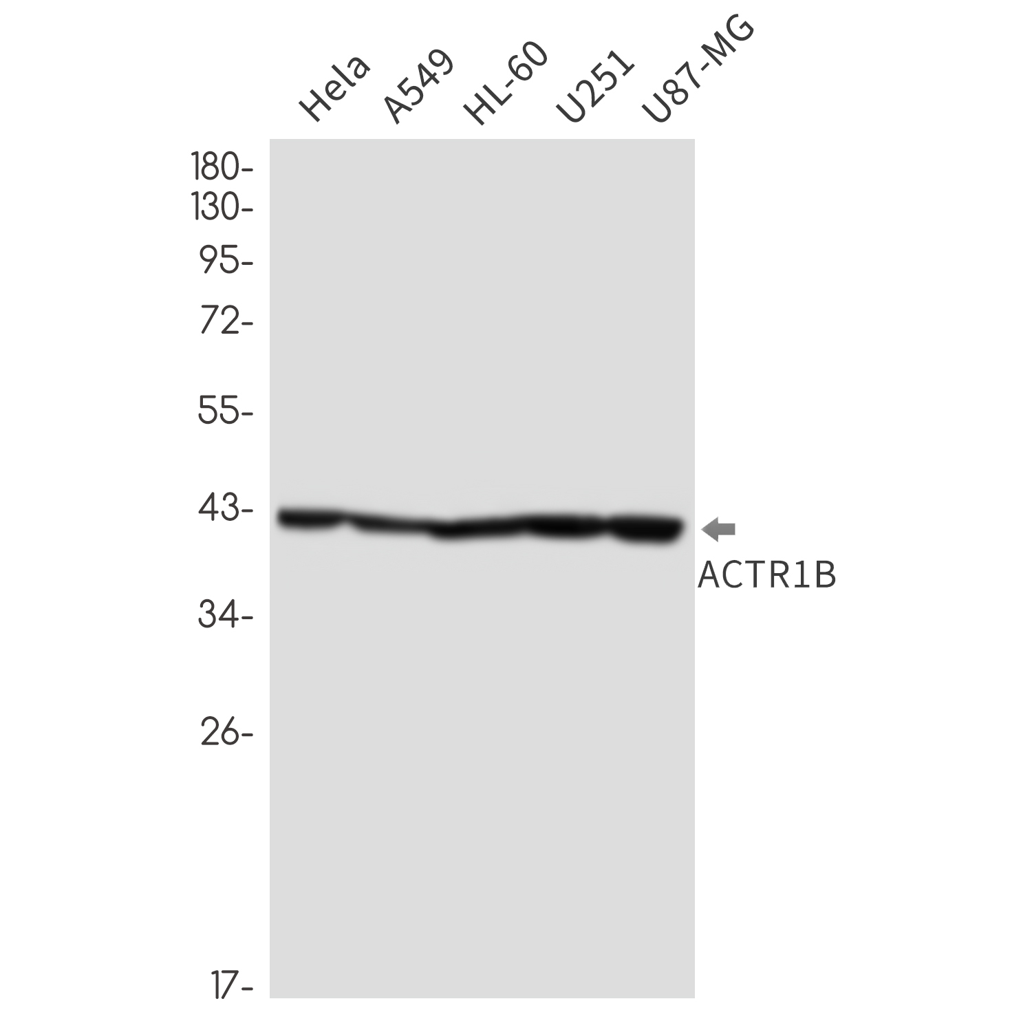 1 - ACTR1B Rabbit mAb AP76380