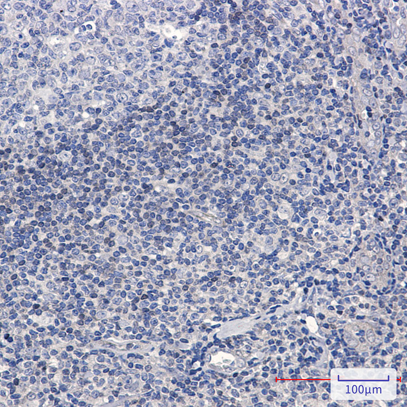 4 - ADK Rabbit mAb AP76381