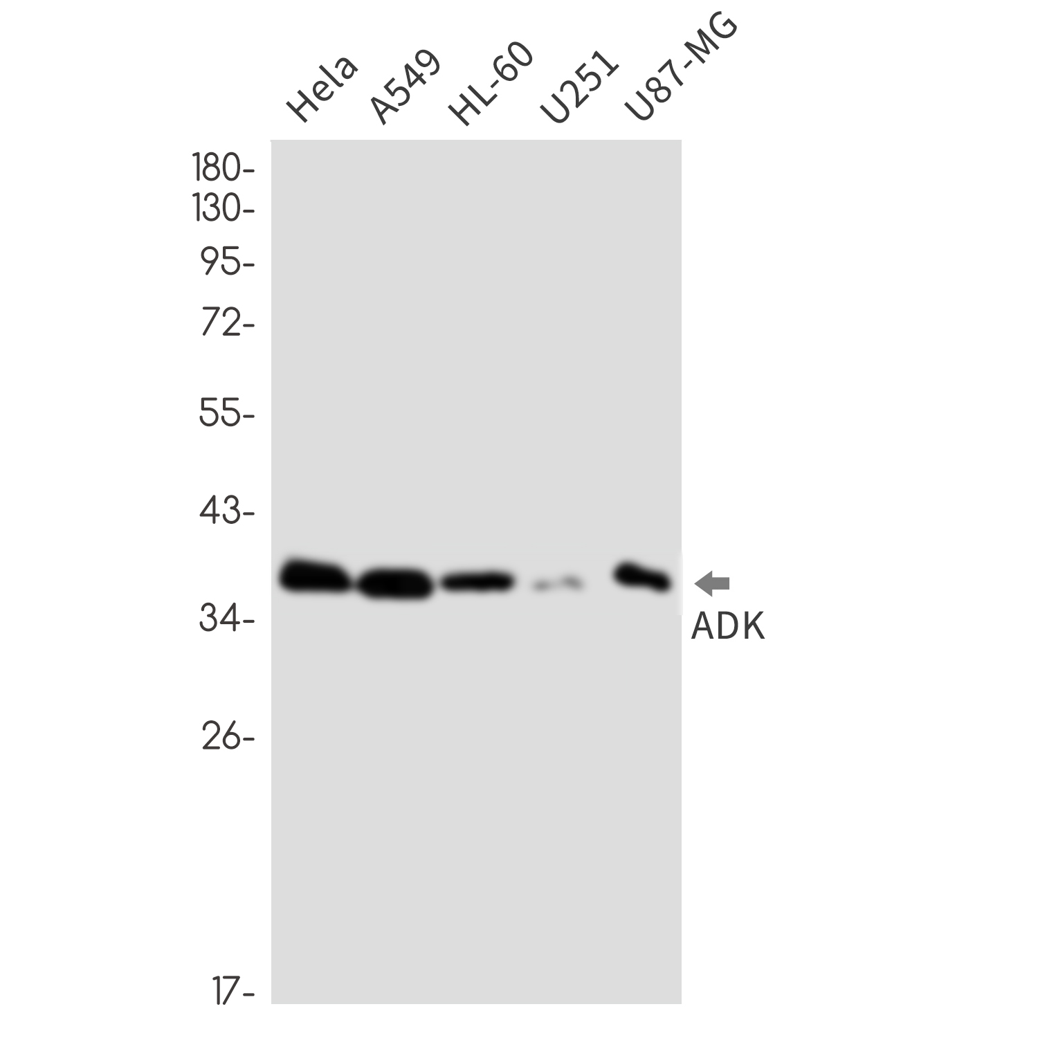 2 - ADK Rabbit mAb AP76381
