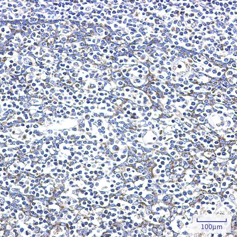 8 - AK2 Rabbit mAb AP76382