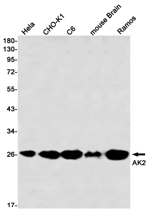 2 - AK2 Rabbit mAb AP76382