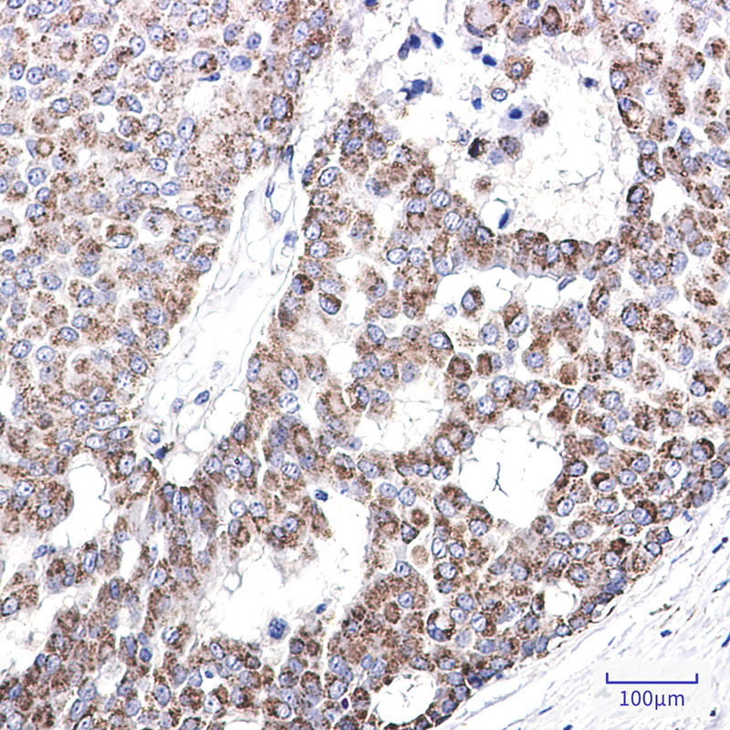 8 - AK3L1 Rabbit mAb AP76383