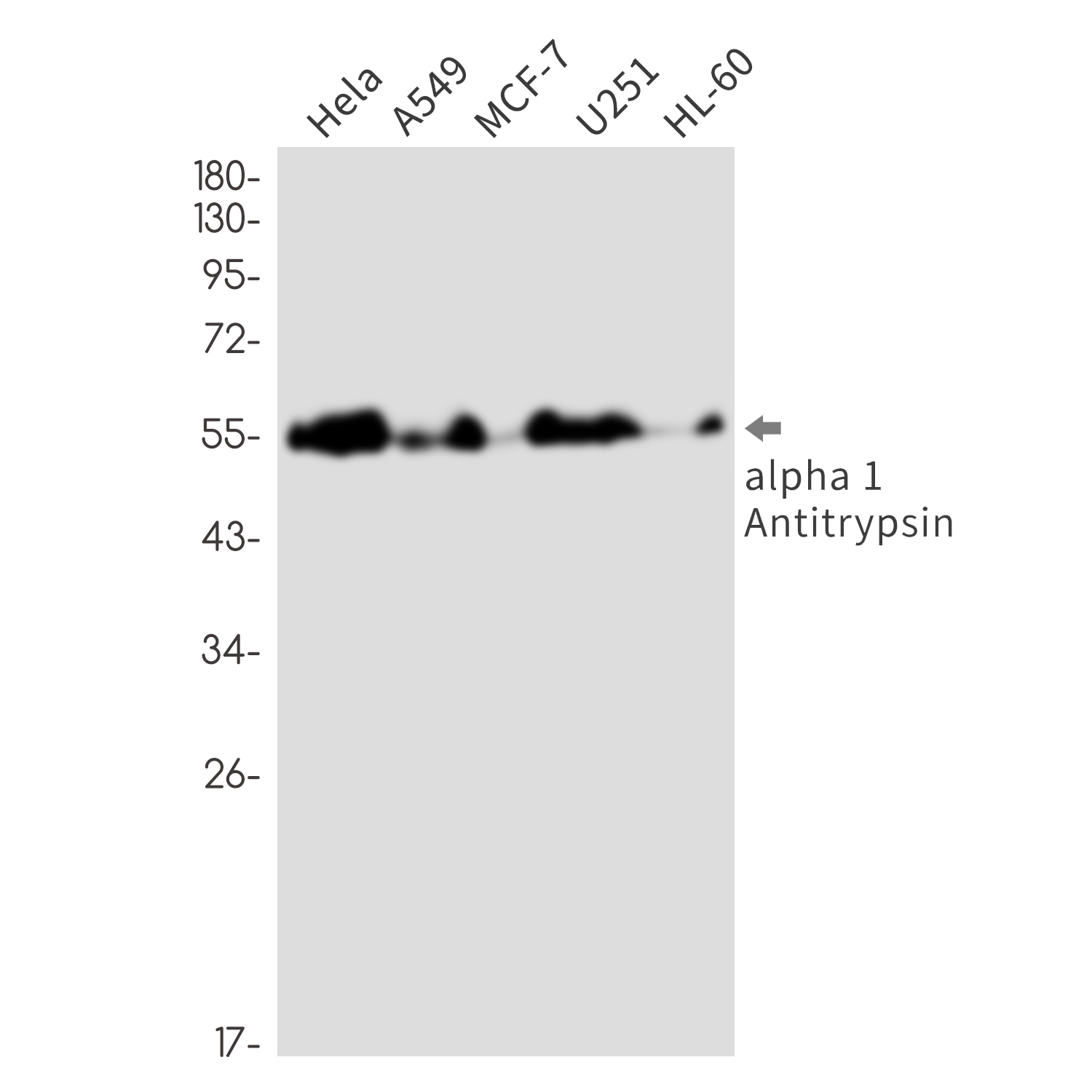 1 - alpha 1 Antitrypsin Rabbit mAb AP76385