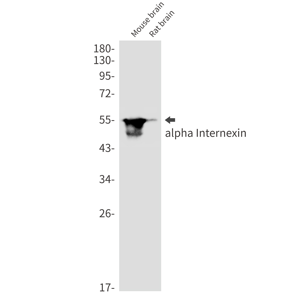 1 - alpha Internexin Rabbit mAb AP76386