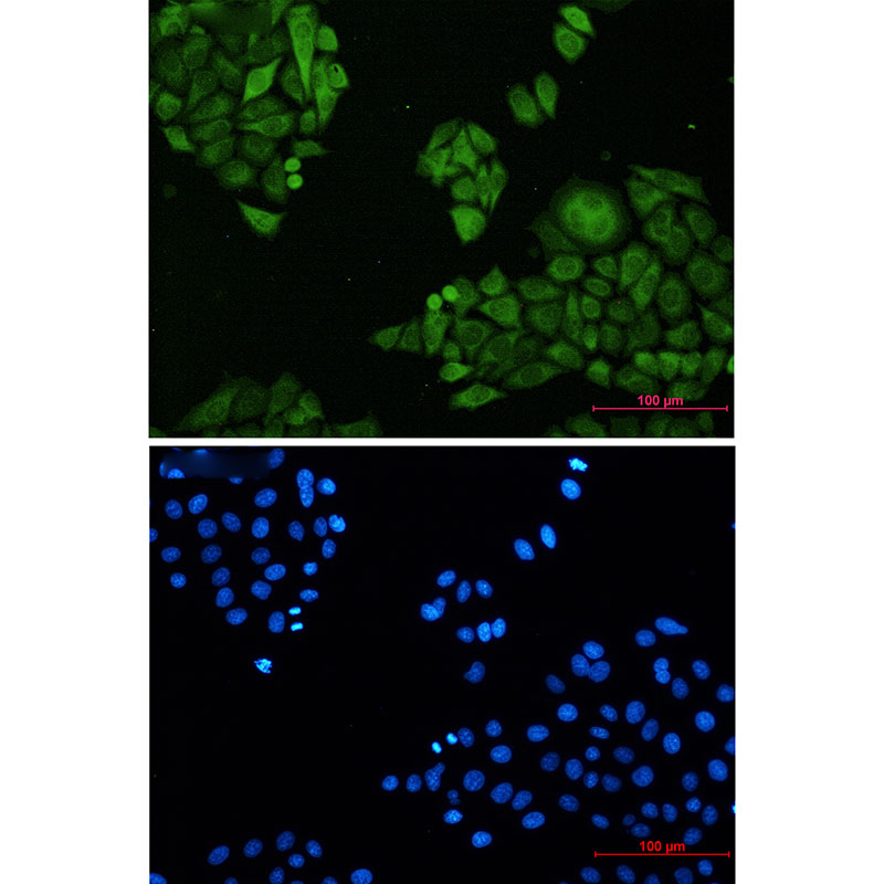 2 - [KO]Annexin 4 Rabbit mAb AP76390
