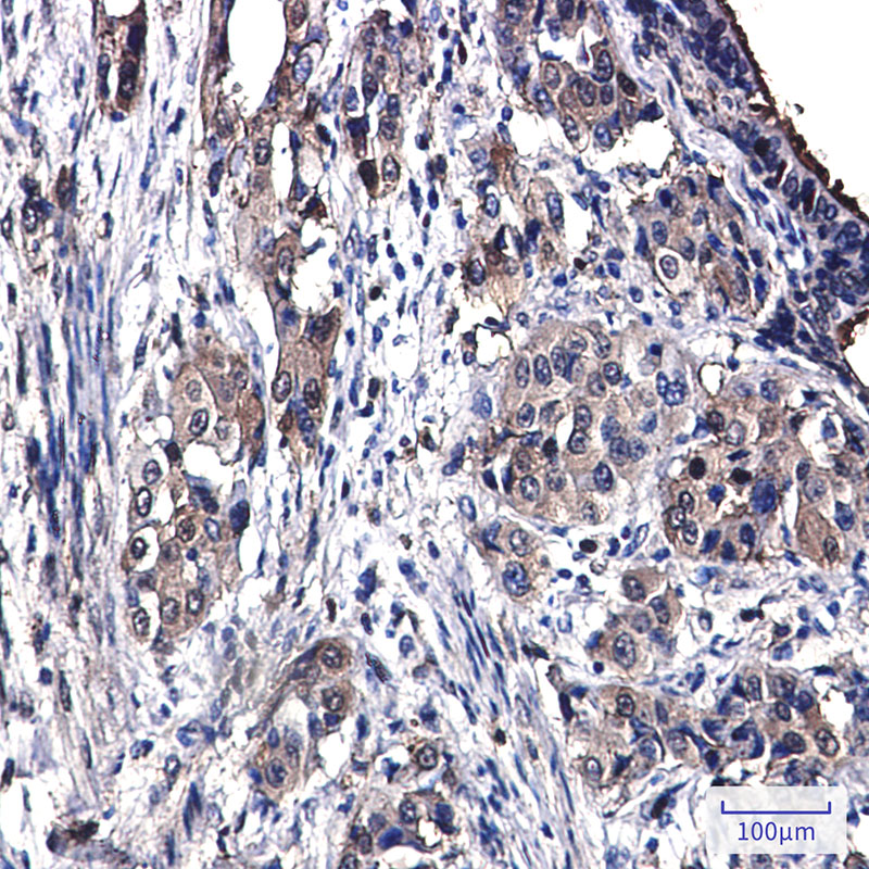 0 - [KO]Annexin 4 Rabbit mAb AP76390