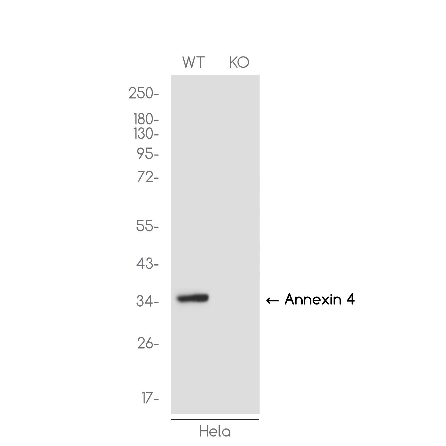 1 - [KO]Annexin 4 Rabbit mAb AP76390