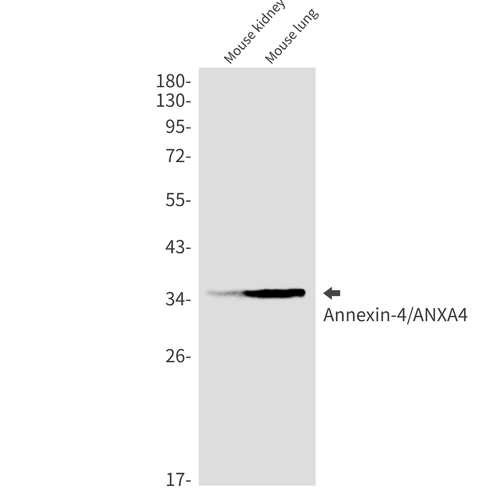 8 - [KO]Annexin 4 Rabbit mAb AP76390
