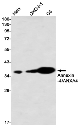 4 - [KO]Annexin 4 Rabbit mAb AP76390