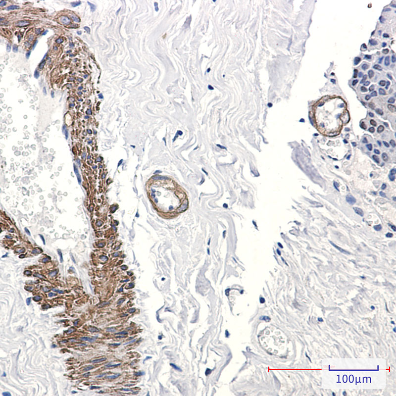 8 - AP2 gamma/TFAP2C Rabbit mAb AP76391