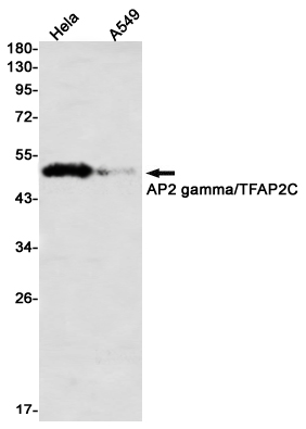 2 - AP2 gamma/TFAP2C Rabbit mAb AP76391