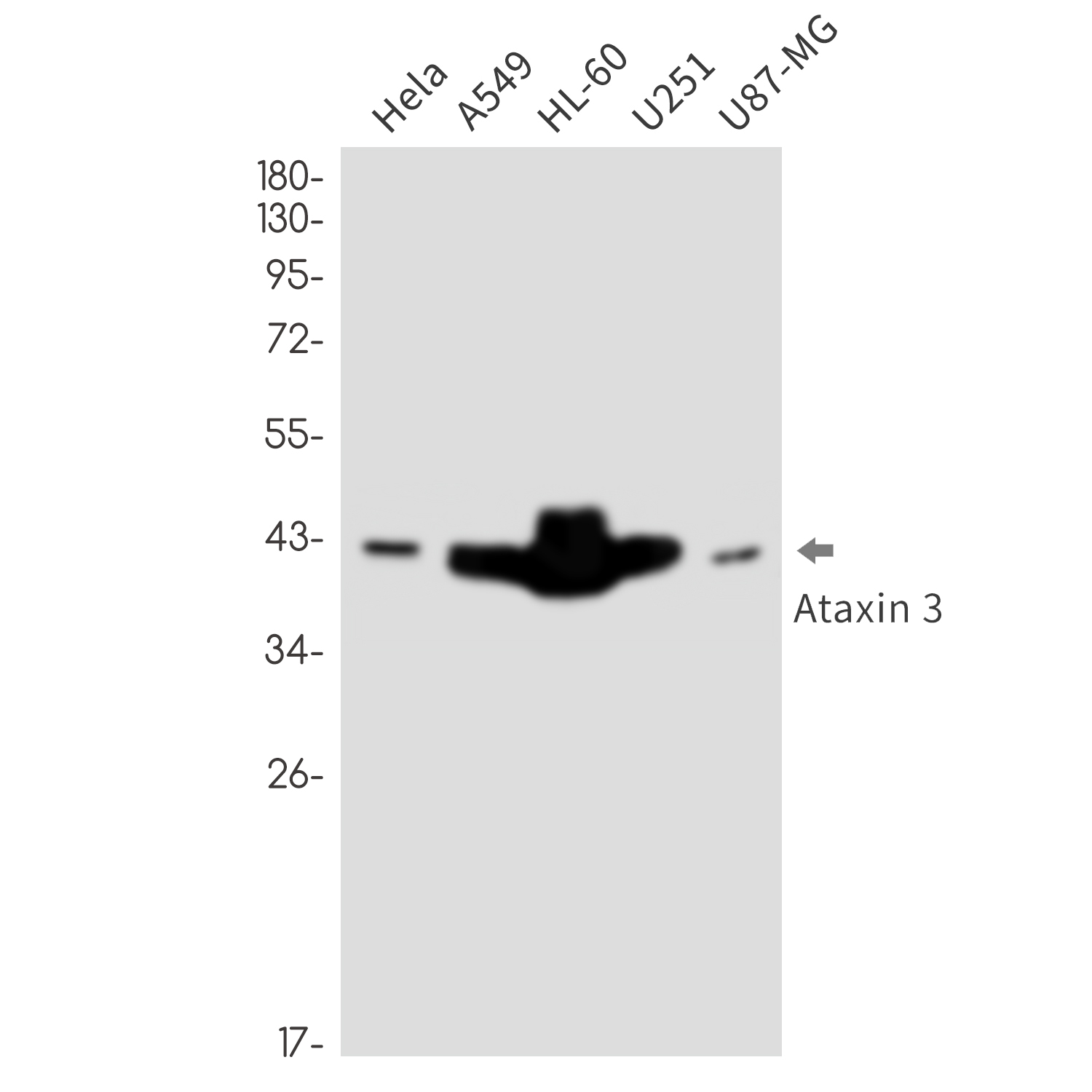 1 - Ataxin 3 Rabbit mAb AP76395