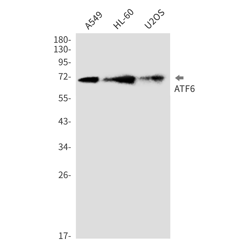 1 - ATF6 Rabbit mAb AP76397