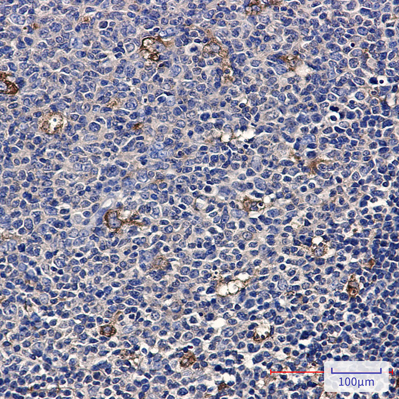 5 - [KD]ATP6V1A Rabbit mAb AP76399