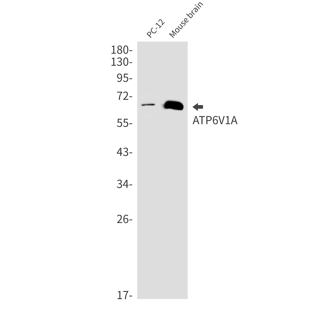 1 - [KD]ATP6V1A Rabbit mAb AP76399