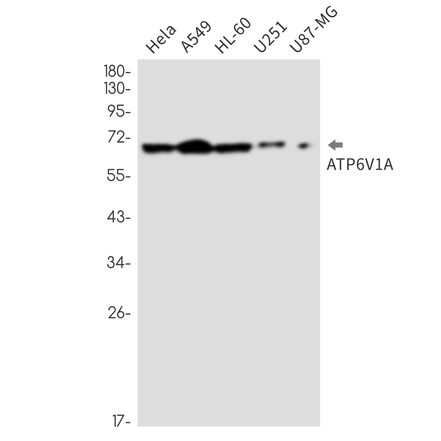 2 - [KD]ATP6V1A Rabbit mAb AP76399