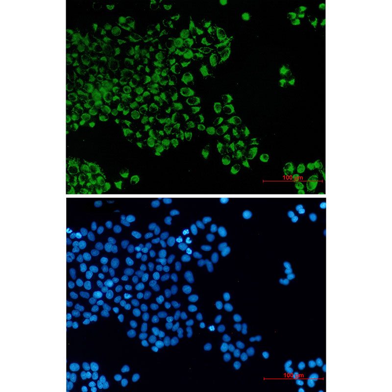 3 - BCL2L14/BCLG Rabbit mAb AP76403