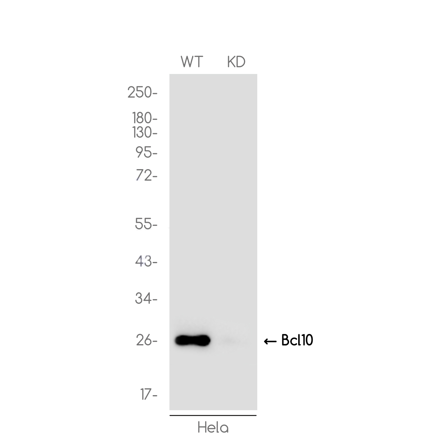 1 - [KD]Bcl 10 Rabbit mAb AP76404