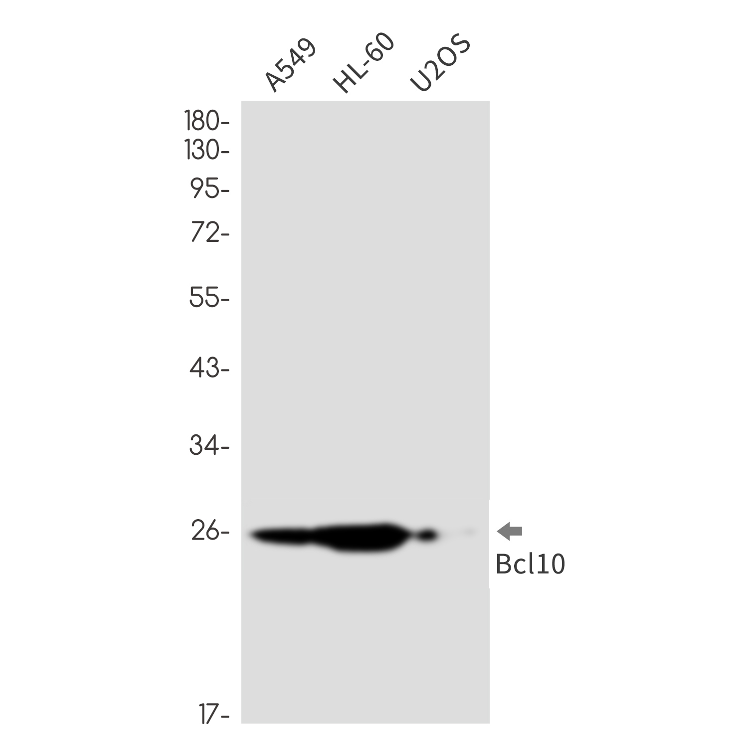 2 - [KD]Bcl 10 Rabbit mAb AP76404