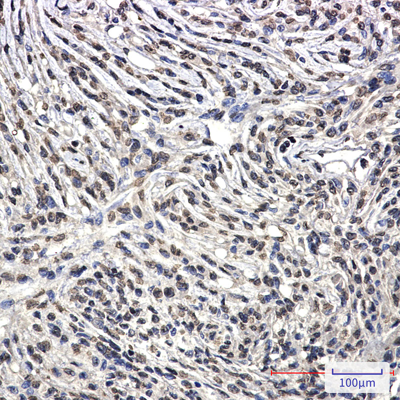 1 - [KO]Bcr Rabbit mAb AP76406