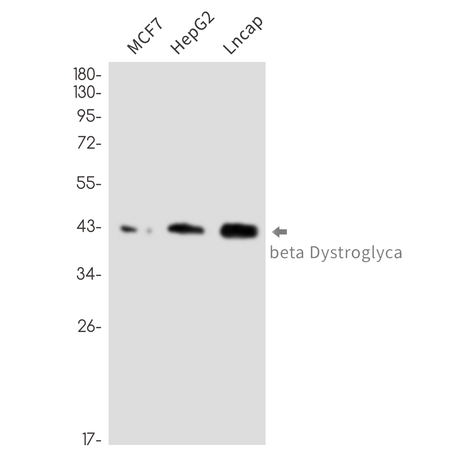 1 - [KO]beta Dystroglycan Rabbit mAb AP76408