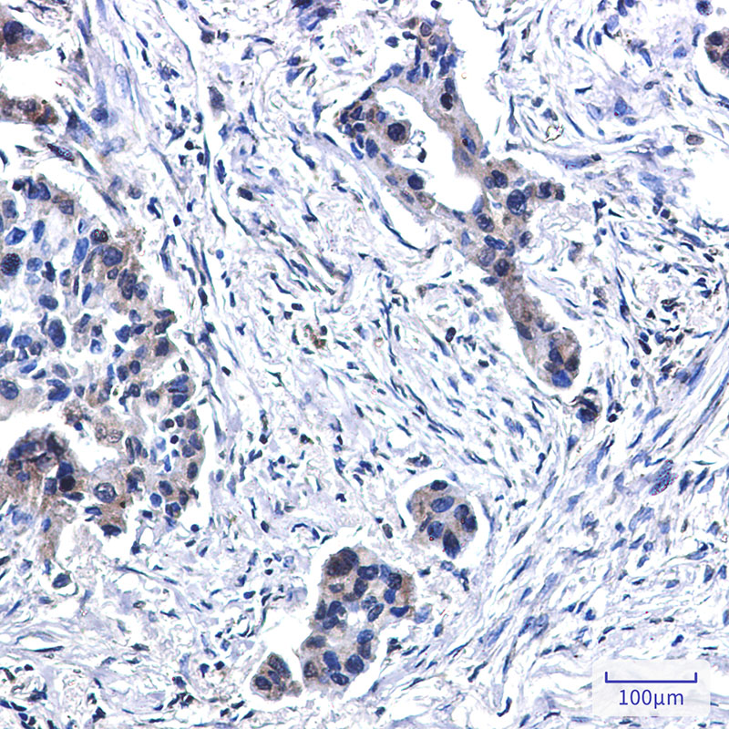 2 - BubR1 Rabbit mAb AP76413