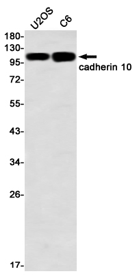 4 - Cadherin 10 Rabbit mAb AP76415