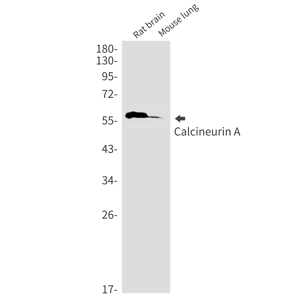 1 - Calcineurin A Rabbit mAb AP76416