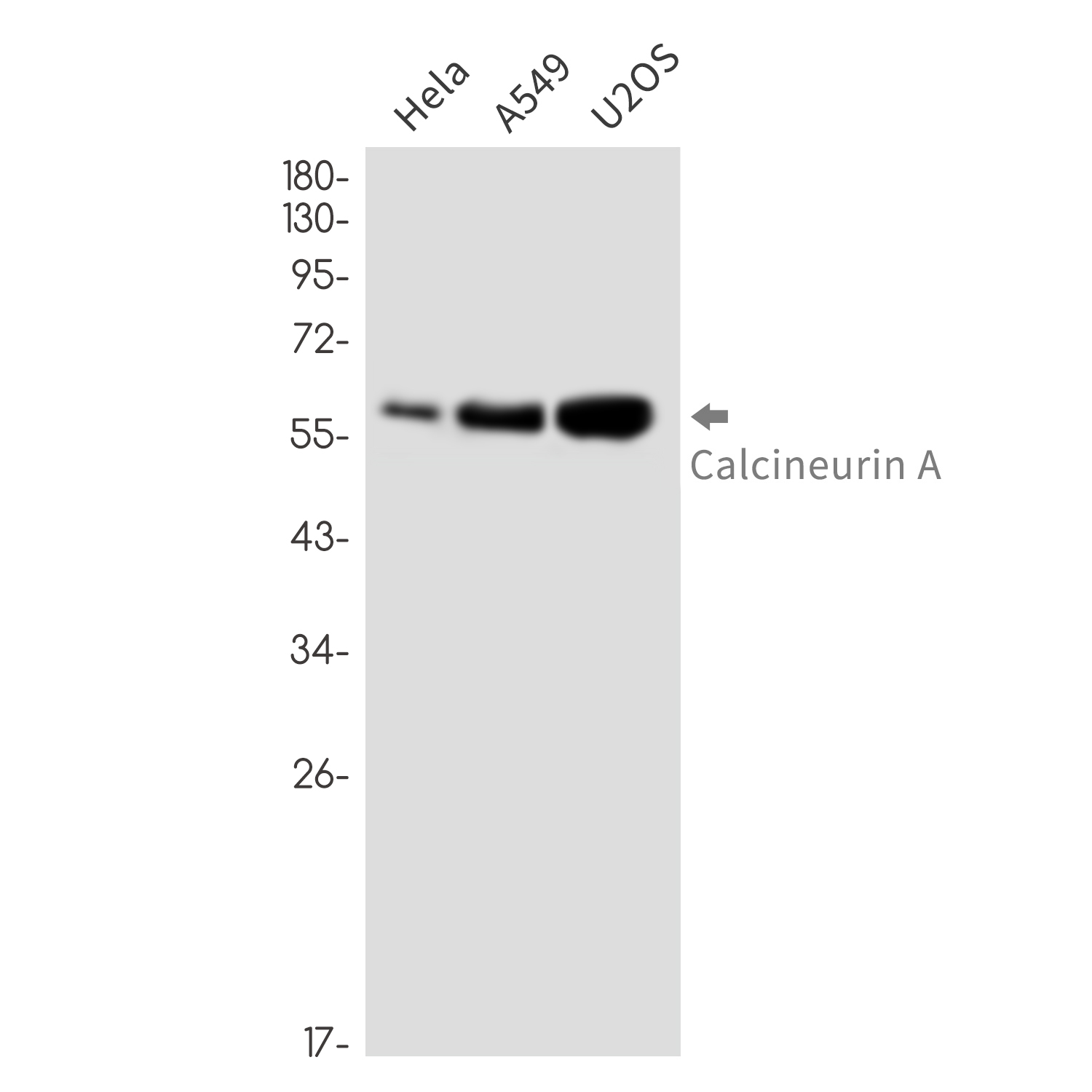 4 - Calcineurin A Rabbit mAb AP76416