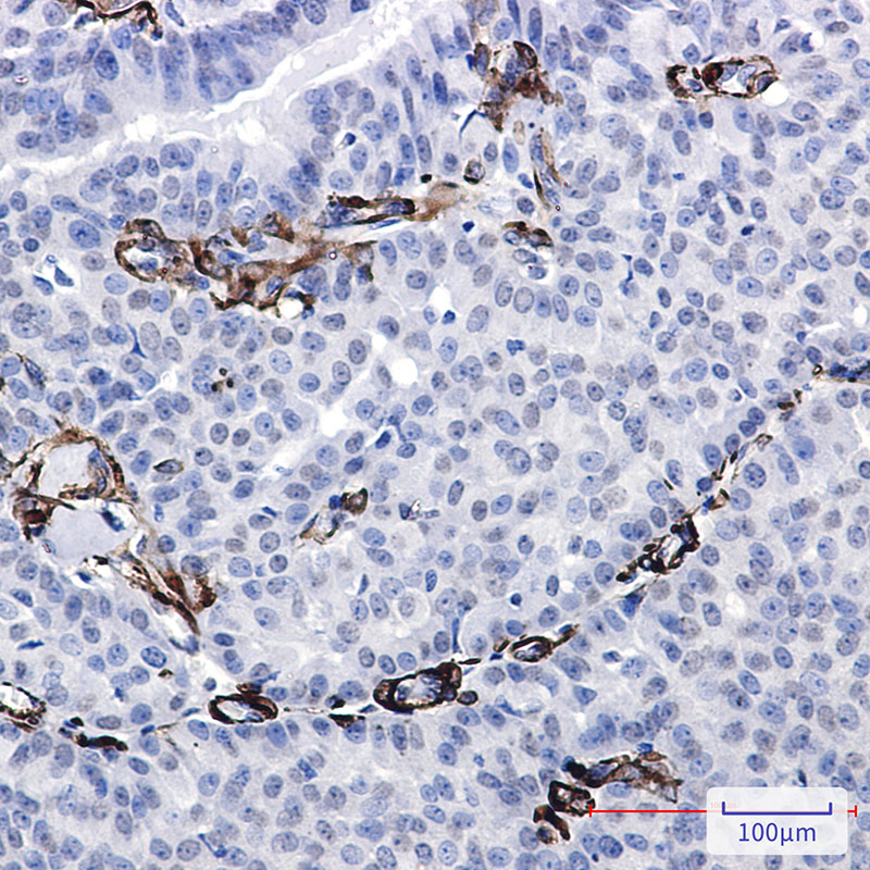 0 - Caldesmon/CDM Rabbit mAb AP76417