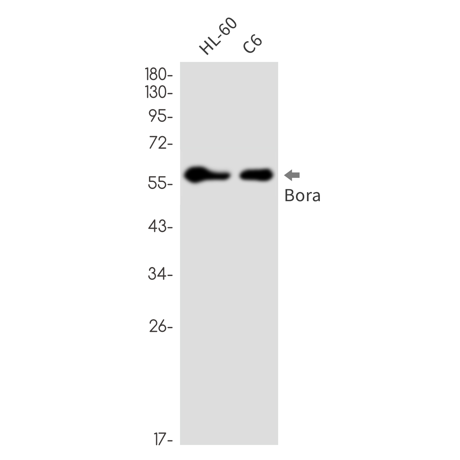 1 - Caldesmon/CDM Rabbit mAb AP76417