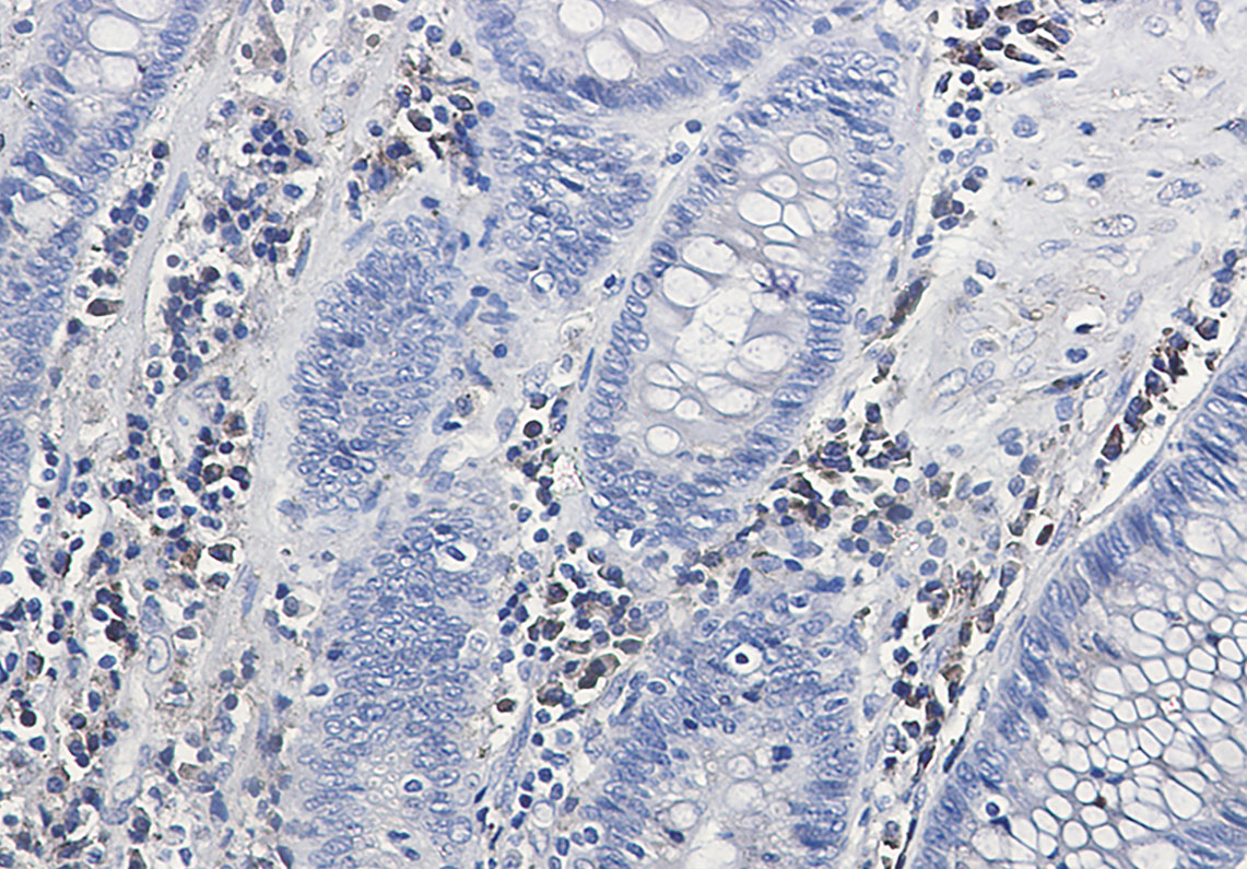 2 - Calumenin Rabbit mAb AP76418