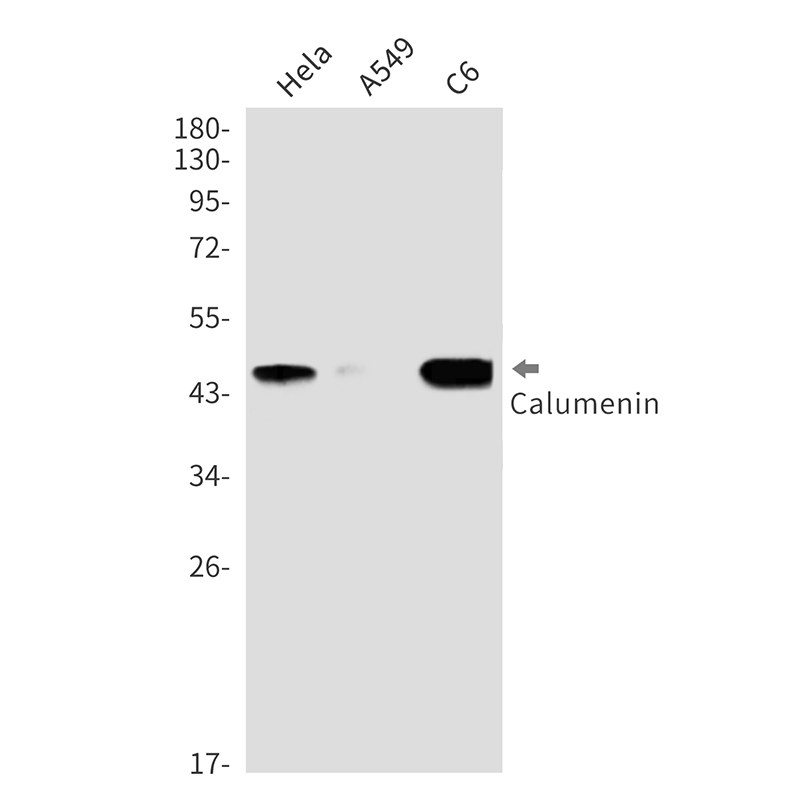1 - Calumenin Rabbit mAb AP76418