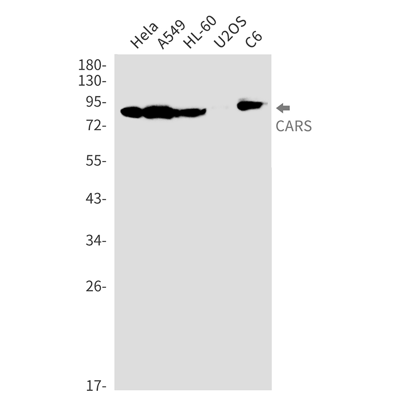 1 - CARS Rabbit mAb AP76419