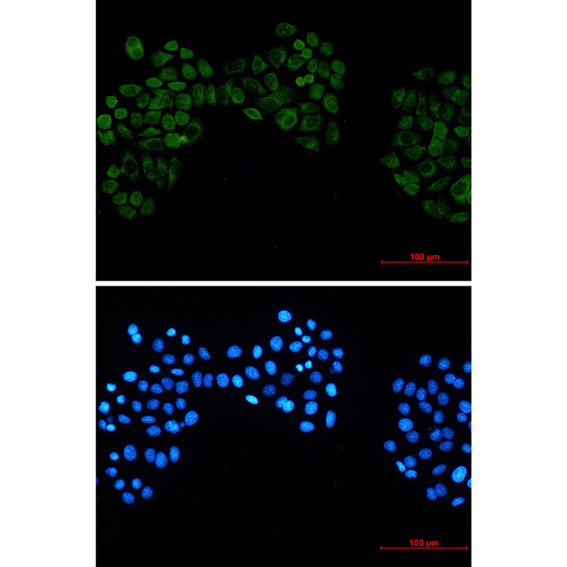 1 - Casein Kinase 2 beta Rabbit mAb AP76420