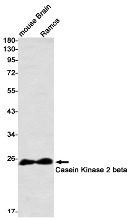 8 - Casein Kinase 2 beta Rabbit mAb AP76420