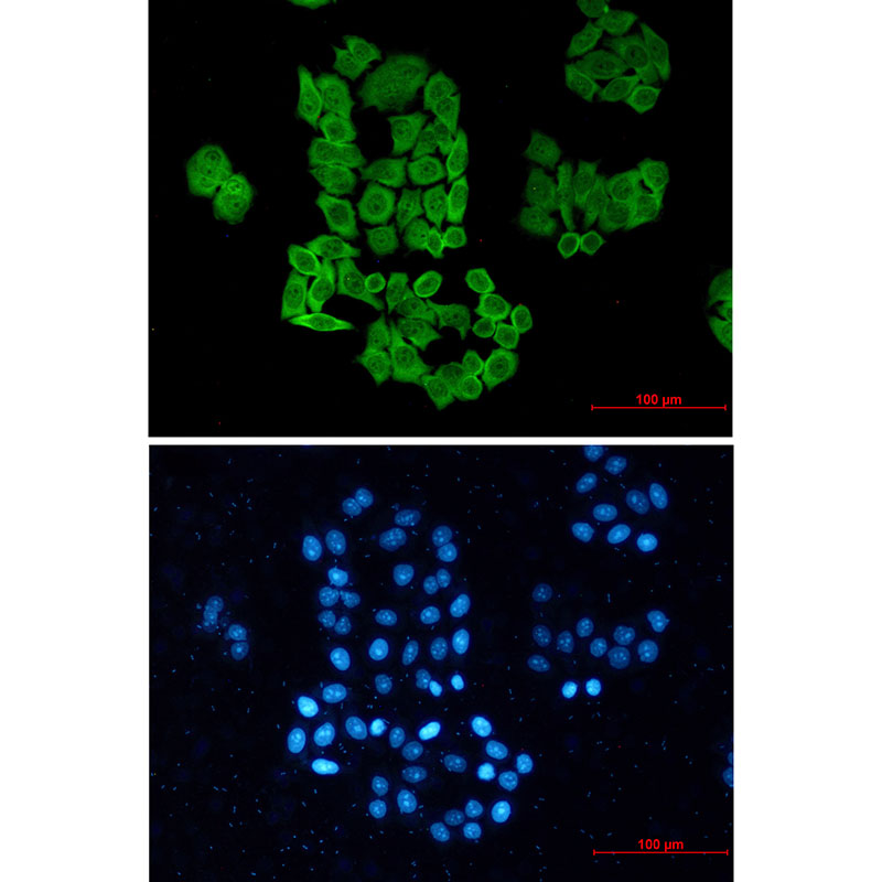 4 - CCT2 Rabbit mAb AP76425
