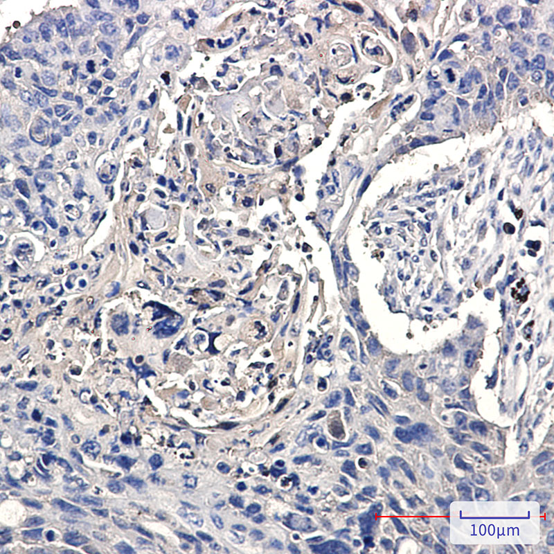 8 - CCT2 Rabbit mAb AP76425