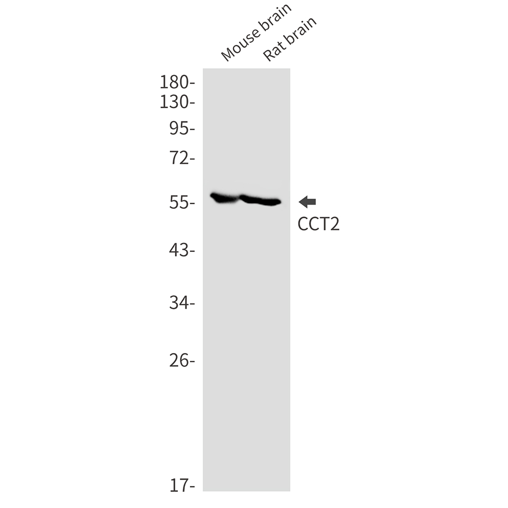1 - CCT2 Rabbit mAb AP76425