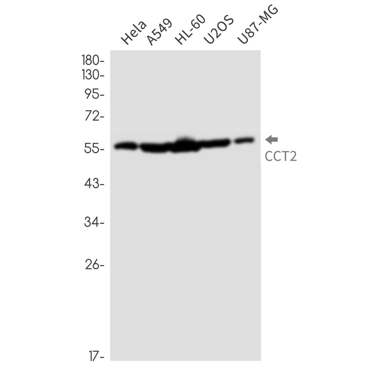 2 - CCT2 Rabbit mAb AP76425
