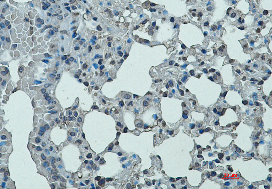 1 - CD11a Rabbit mAb AP76427