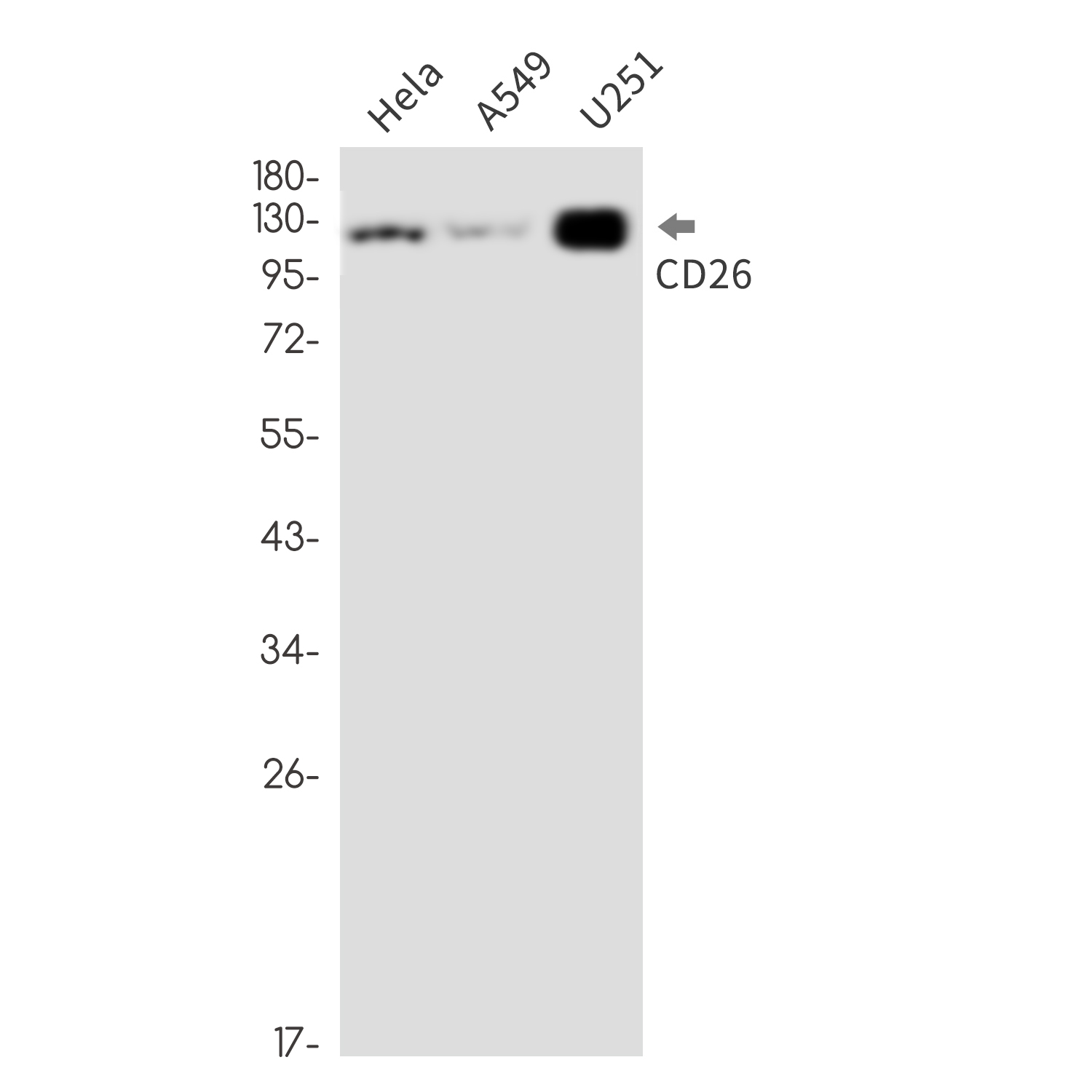 1 - DPP4 Rabbit mAb AP76429
