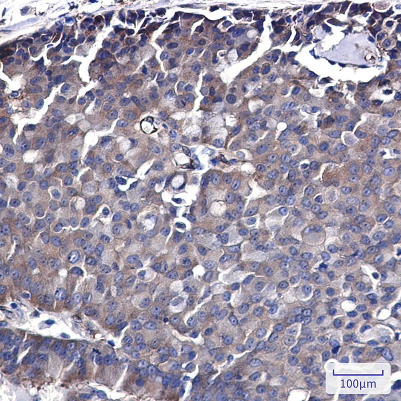 2 - CDC37 Rabbit mAb AP76434