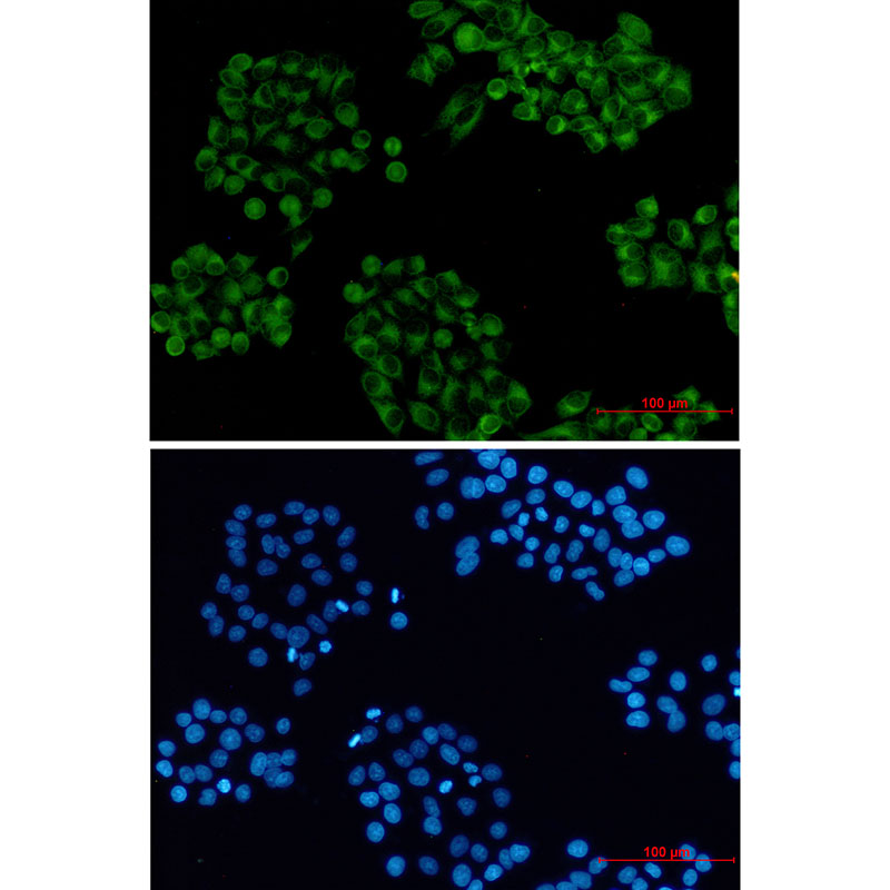 3 - Cellubrevin Rabbit mAb AP76437
