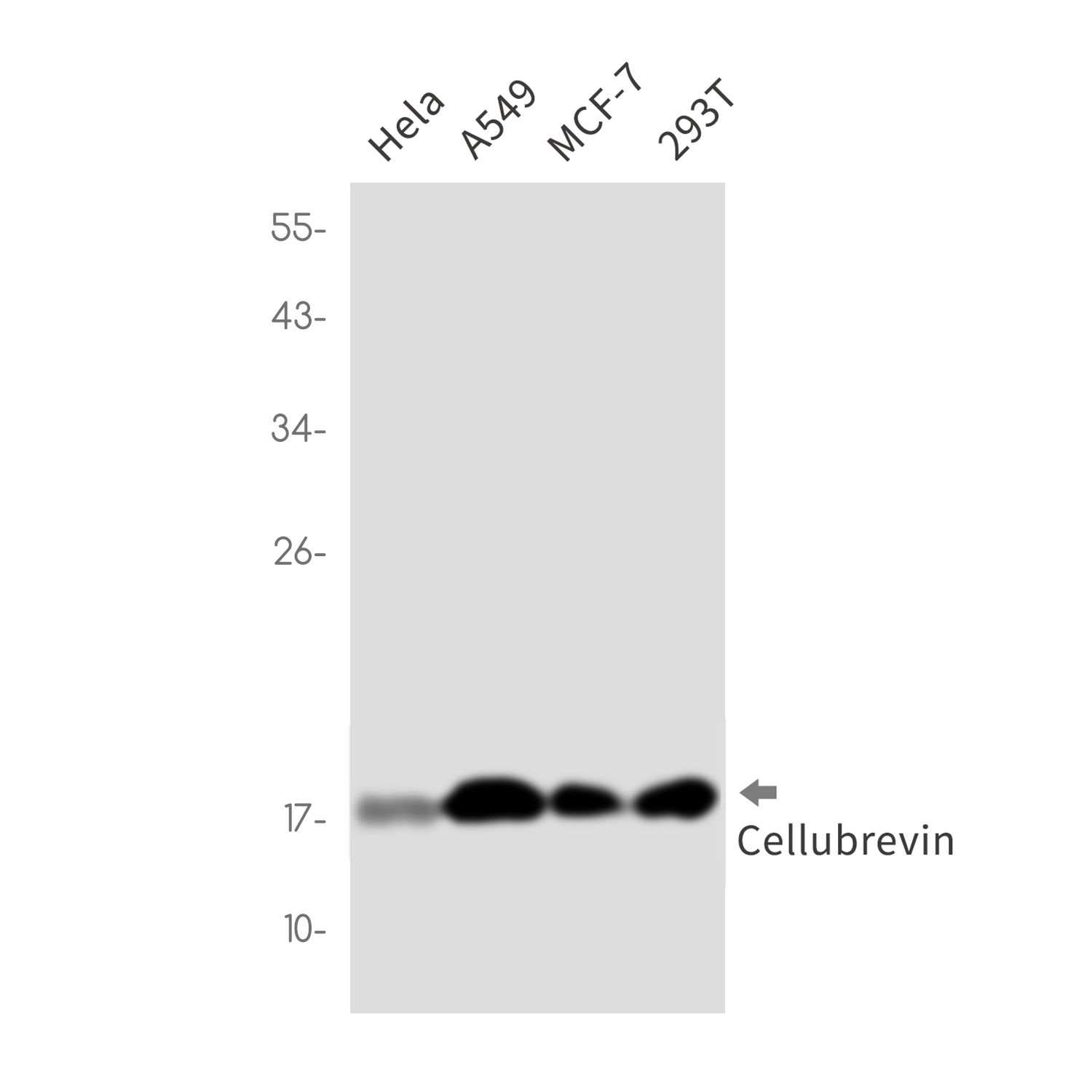 1 - Cellubrevin Rabbit mAb AP76437