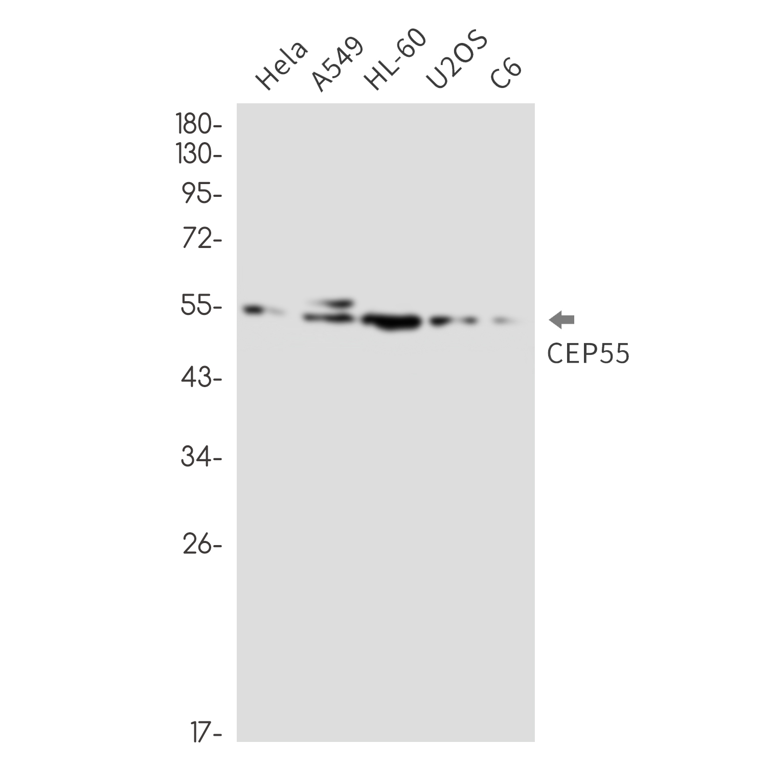 2 - CEP55 Rabbit mAb AP76438