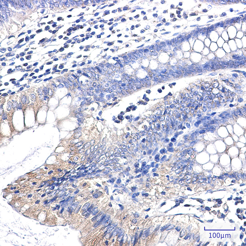 2 - [KO]Clathrin Heavy Chain Rabbit mAb AP76441