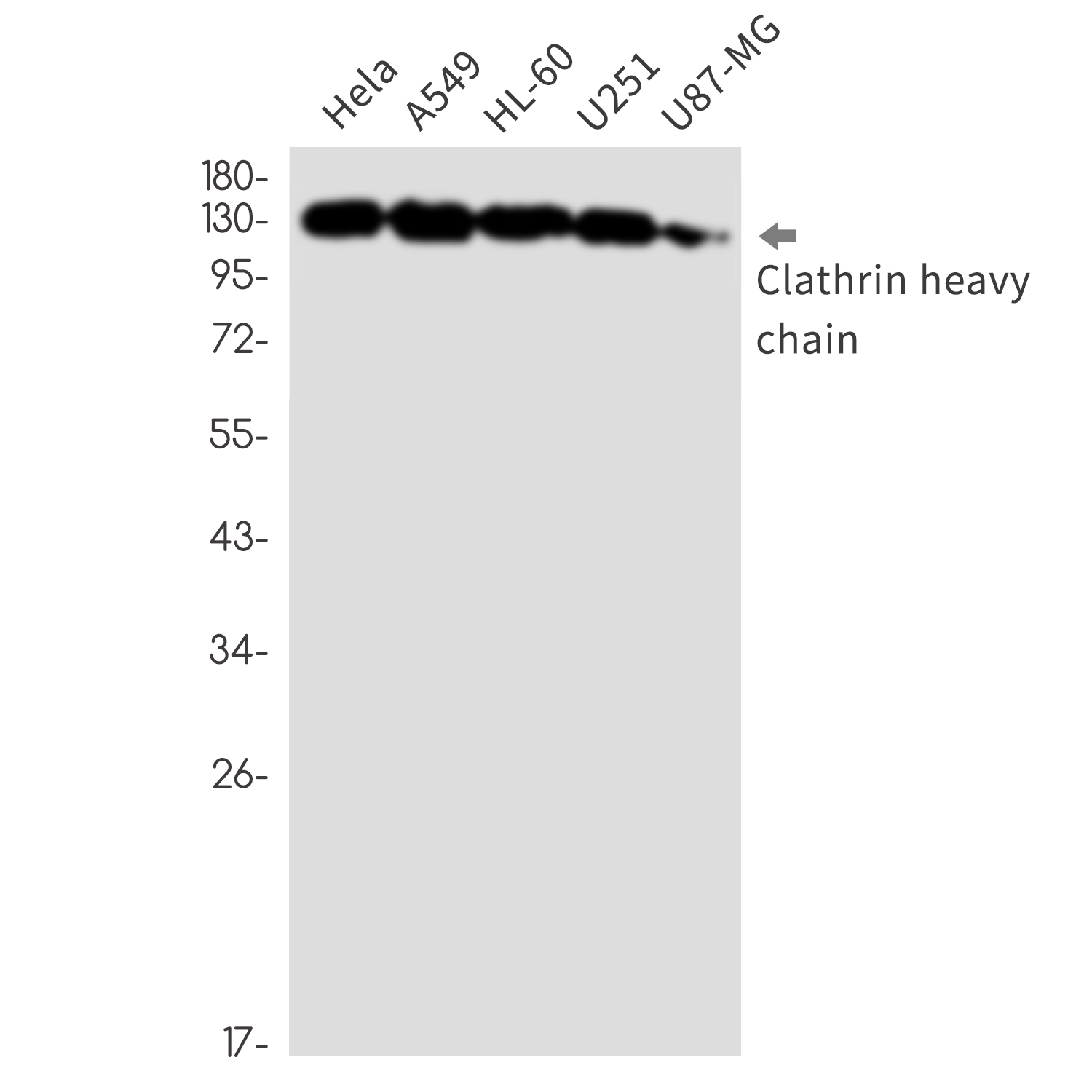 1 - [KO]Clathrin Heavy Chain Rabbit mAb AP76441