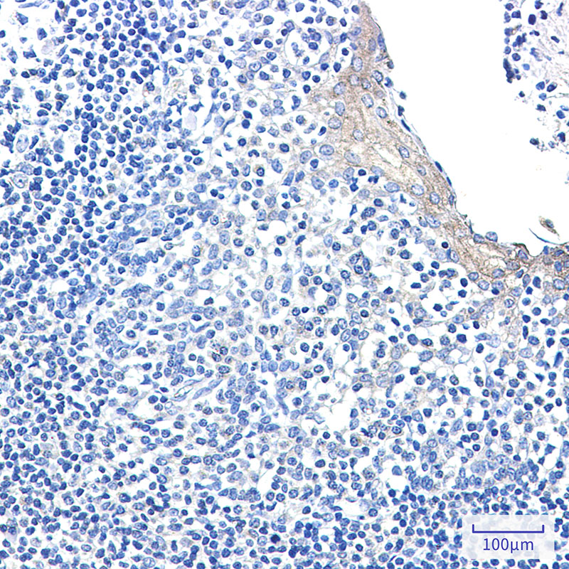 2 - CLIP170 Rabbit mAb AP76443