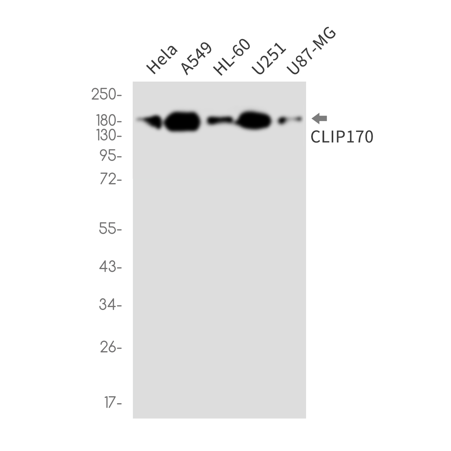 1 - CLIP170 Rabbit mAb AP76443